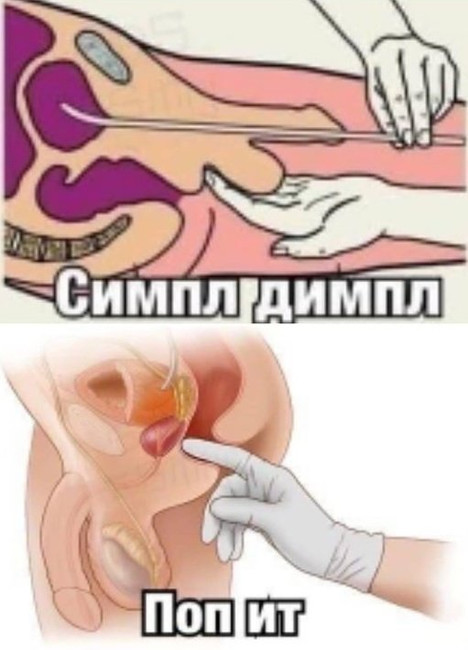 Симпл димпл - Поп ит